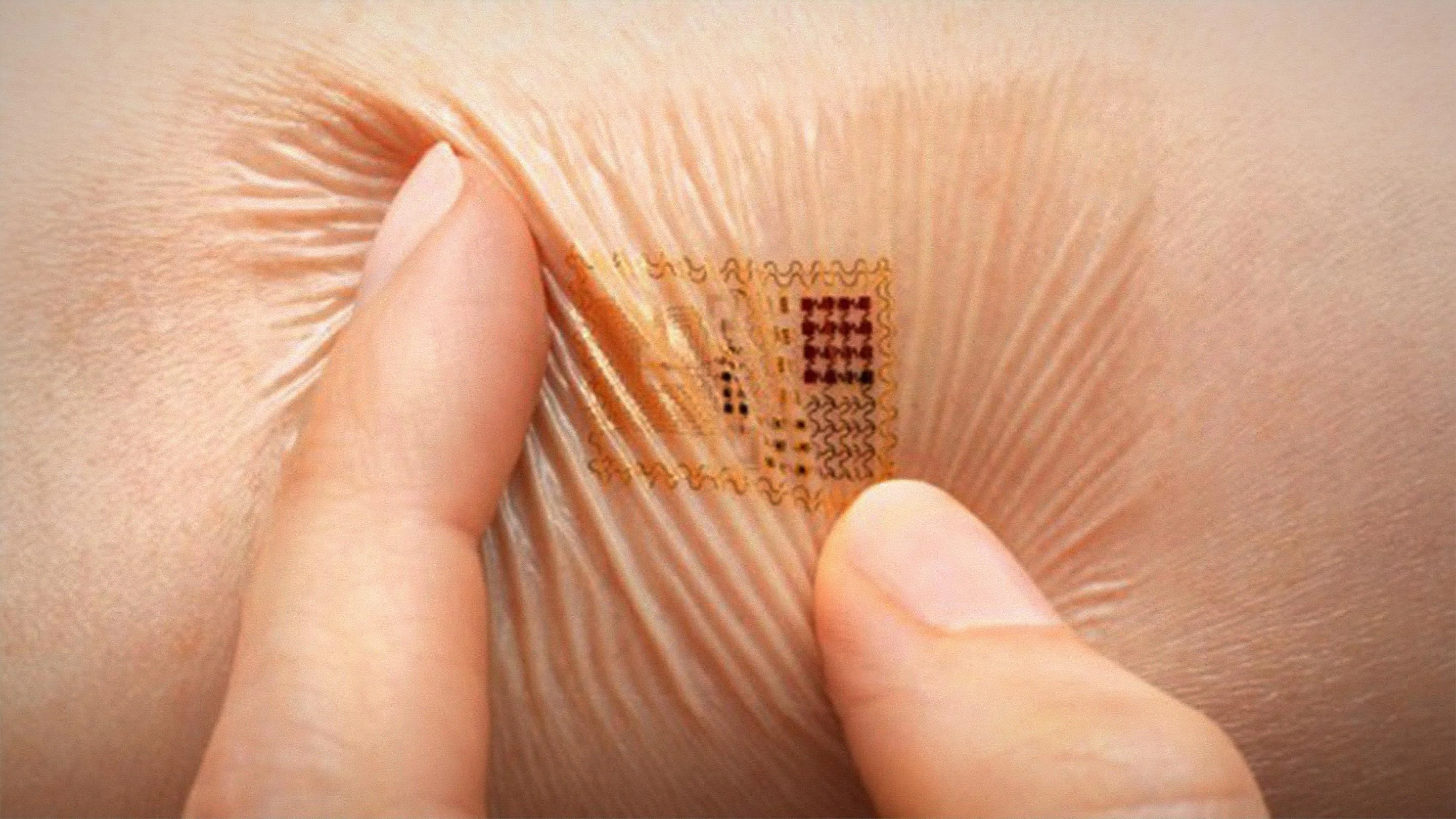 Scientists have created an implant for blood analysis
