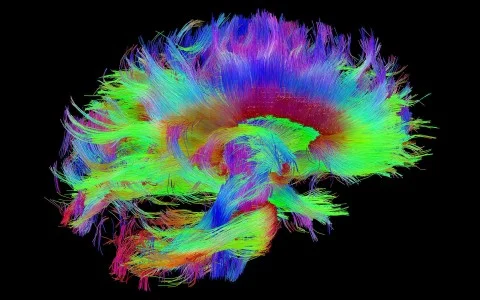 Scientists from Australia have created a map of the human brain